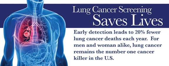 Lung cancer screening saves lives.